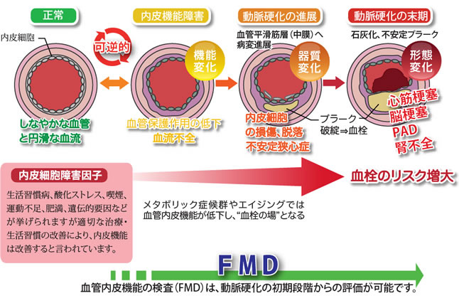 FMD検査（血管皮内機能検査）